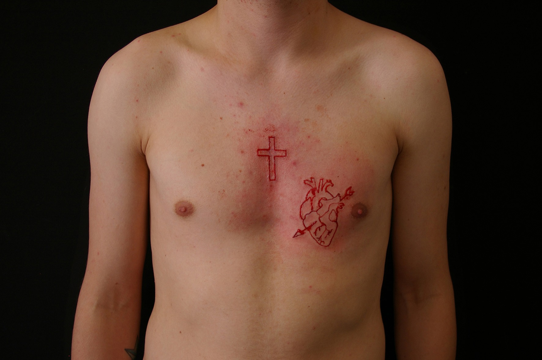 Zdjęcie. Tors mężczyzny ze skaryfikacjami w kształcie krzyża i serca.